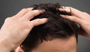 why hair loss out and how to stop it 2022