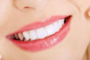 White teeth: 4 Effective Home Remedies For White teeth