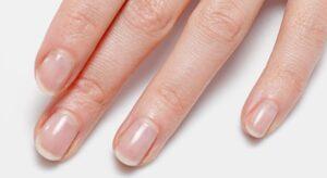 Colour of your nails says about your health